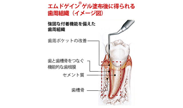 エムドゲイン