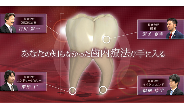 歯内療法（エンド）を学ぶ「yes」の存在意義